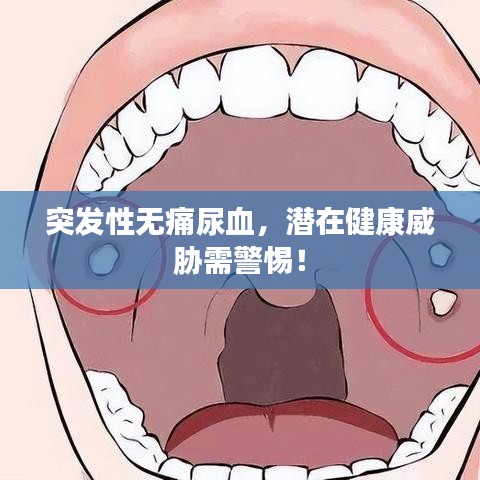 突发性无痛尿血，潜在健康威胁需警惕！