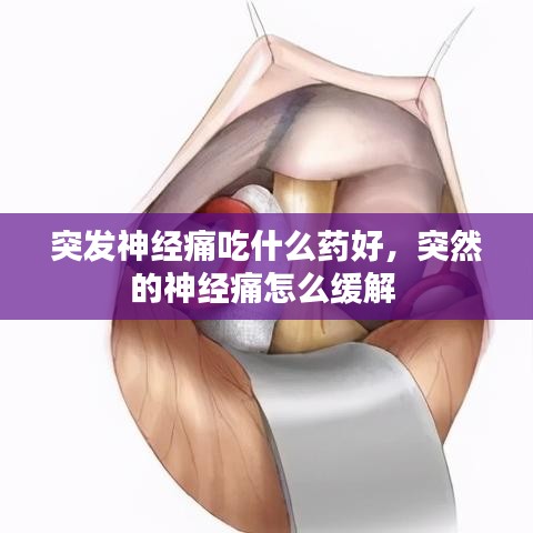 突发神经痛吃什么药好，突然的神经痛怎么缓解 