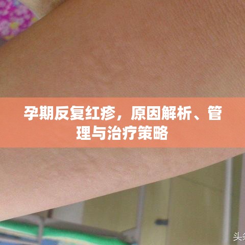 孕期反复红疹，原因解析、管理与治疗策略