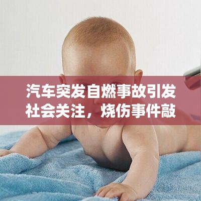 汽车突发自燃事故引发社会关注，烧伤事件敲响安全警钟